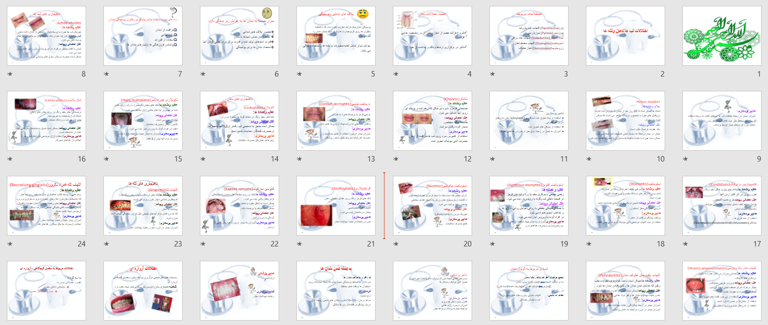  پاورپوینت اختلالات لب ها، دهان و لثه ها